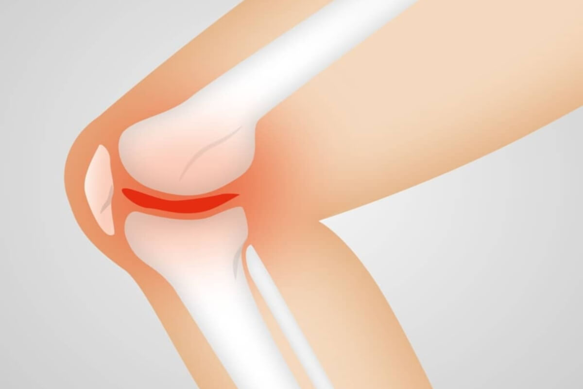 Non-invasive, drug-free PEMF therapy can help improve the destructive effects of arthritis